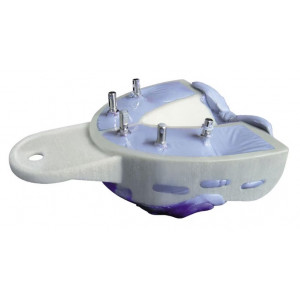 MIRATRAY IMPLANT INTRO KIT...