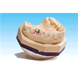 ZEROSTONE AVORIO Kg.5...
